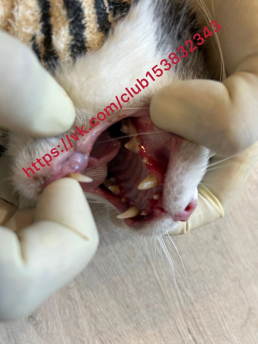 Плачевное состояние зубов и десен