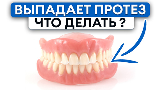 Почему НЕ ДЕРЖИТСЯ зубной ПРОТЕЗ? / Причины выпадения зубного протеза