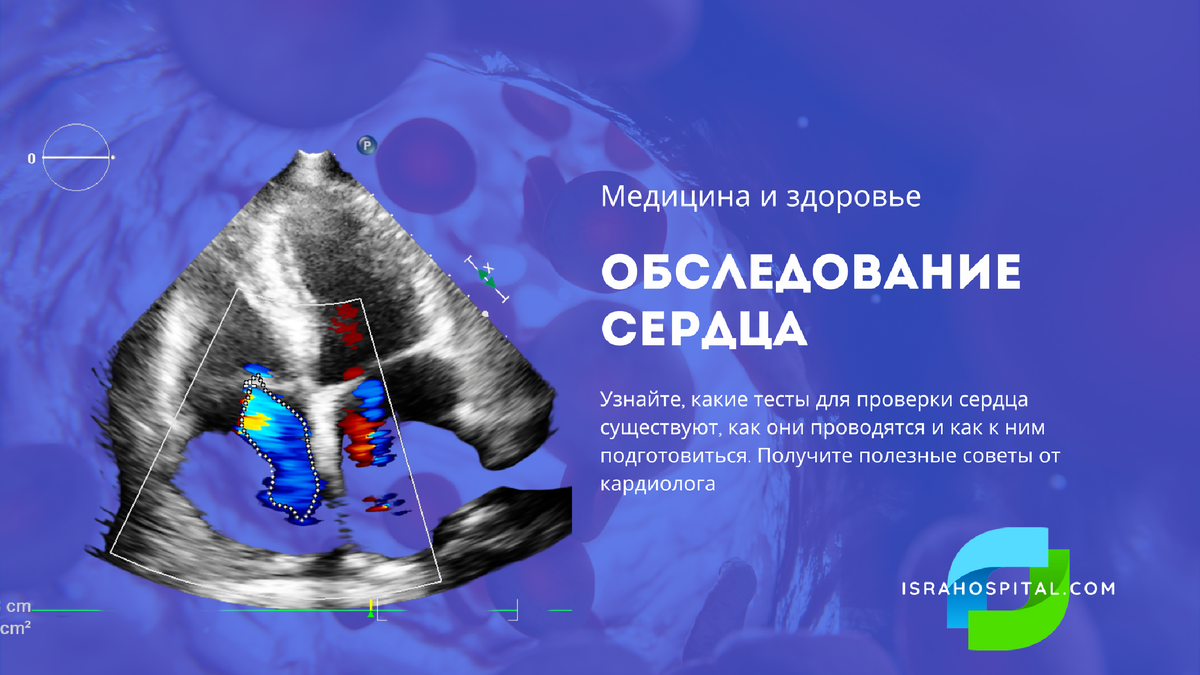 Диагностика заболеваний сердца и сосудов