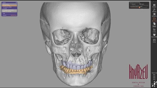 Уникальный метод цифрового позиционирования нижней челюсти как основной алгоритм отладки зубочелюстной системы.