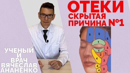 ОТЕКИ Скрытая причина №1