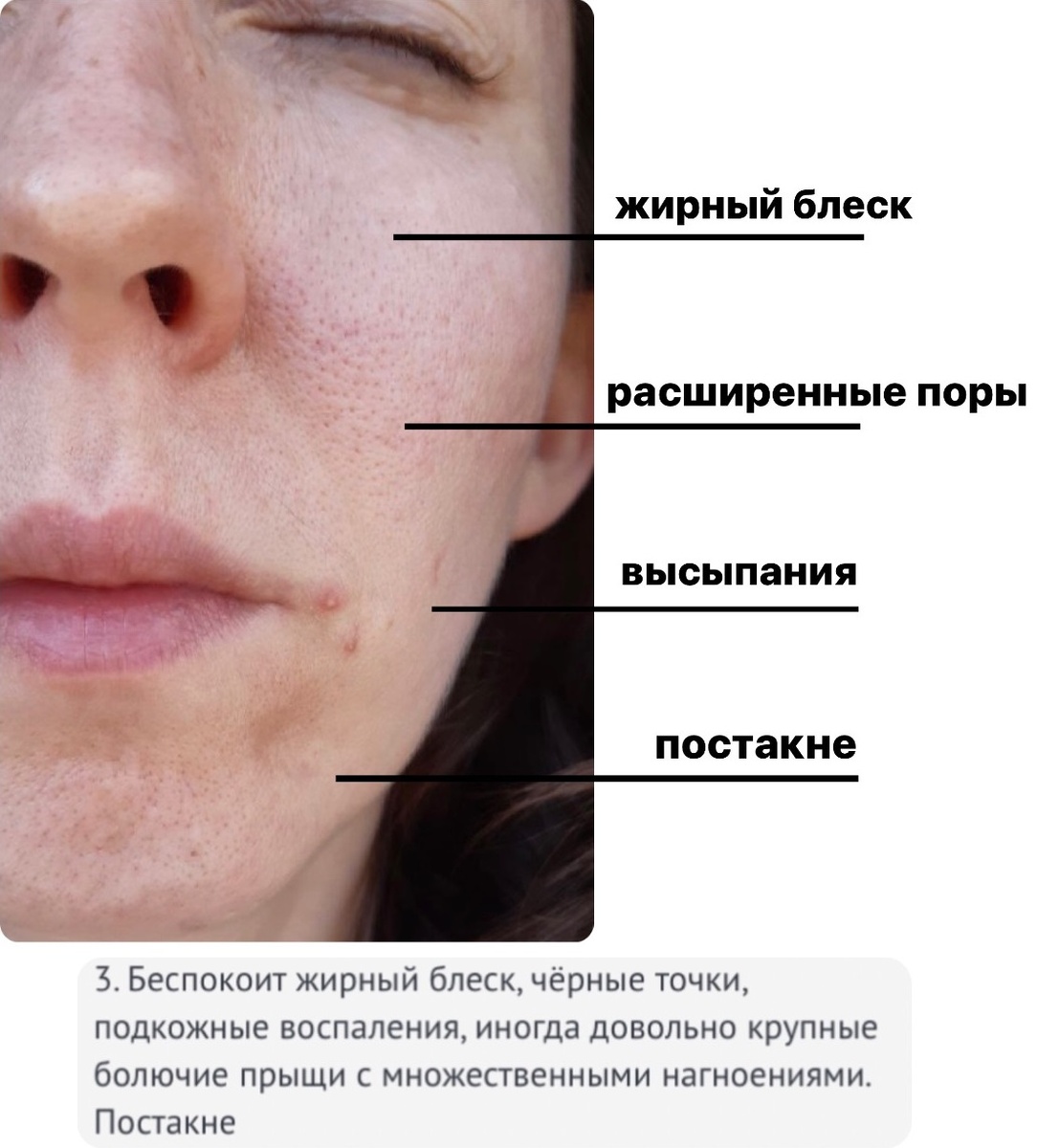 (фрагмент анкеты клиента)