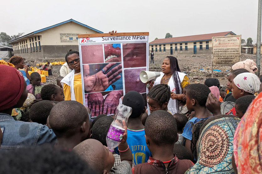 Фото: Augustin Mudiayi / Doctors Without Borders