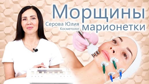 🔬 Уголки губ. Как поднять уголки губ. Серова Юлия - Морщины Марионетки. ЭСМА. Косметология.