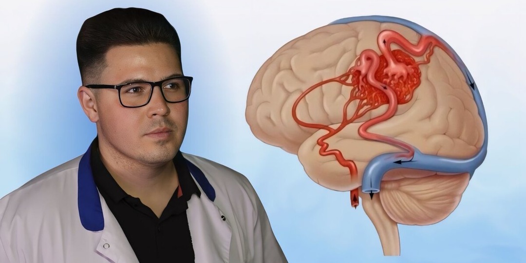 8 признаков нарушения мозгового кровообращения: от снижения мышечной массы до проблем со сном