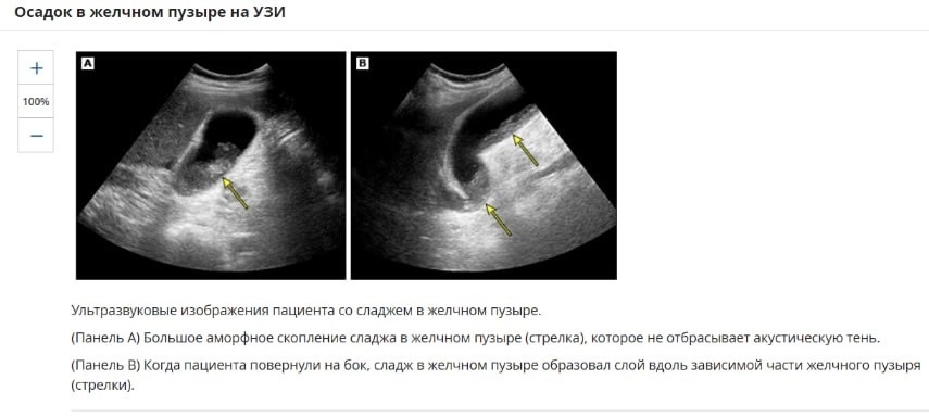 Медицинские статьи на сайте компании Эндомедис