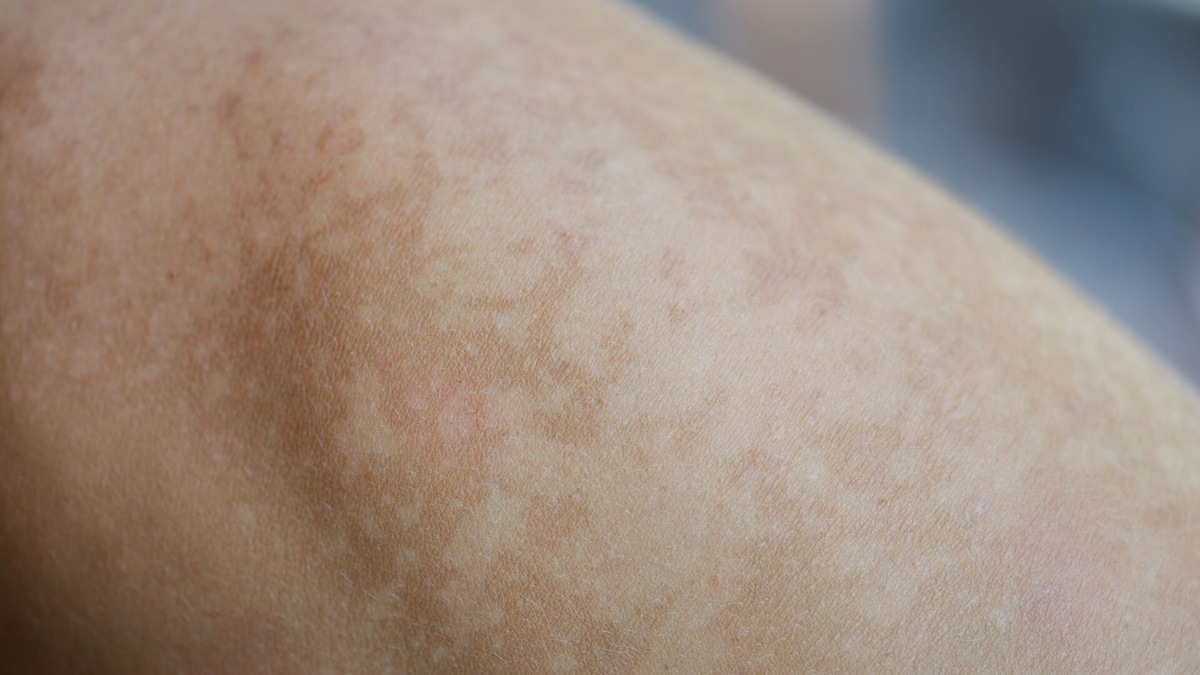 Фото с канала: Денис Потапенко | Советы кинезиолога