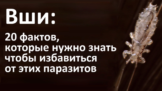 Что нужно знать про вшей и гнид, чтобы самостоятельно избавиться от них в домашних условиях?