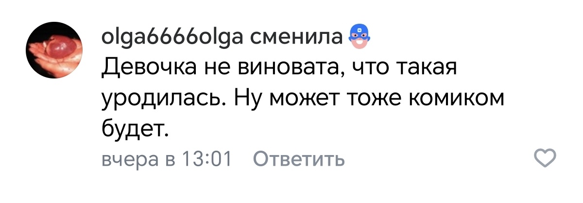 Михаил Галустян - известный КВНэнщик, который выжал максимум из своей внешности.-5