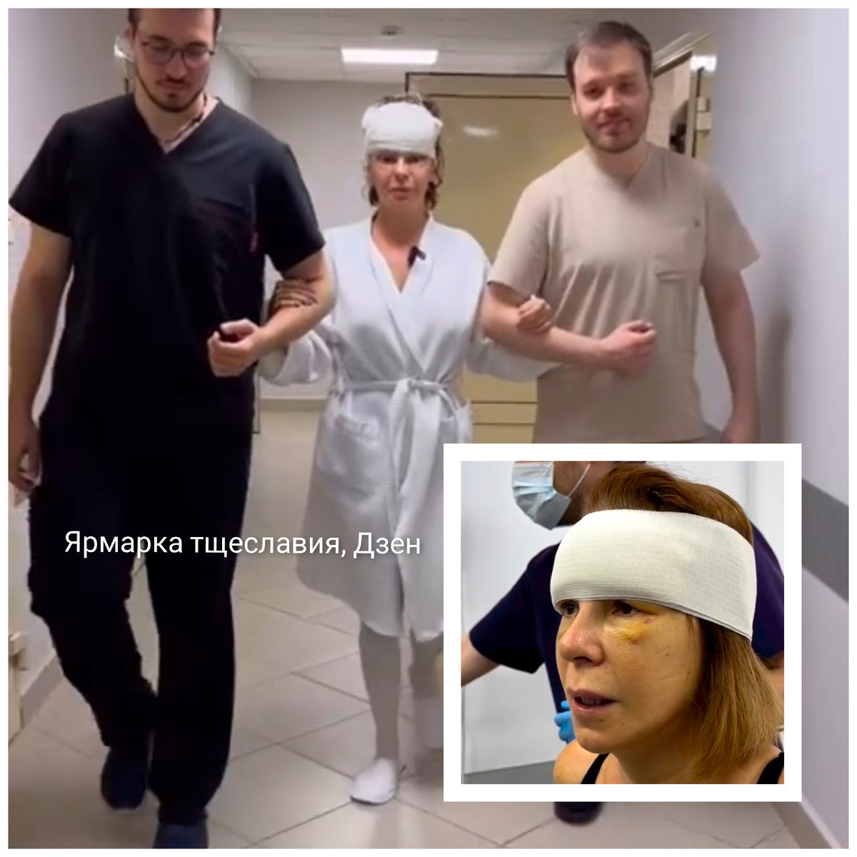 -3