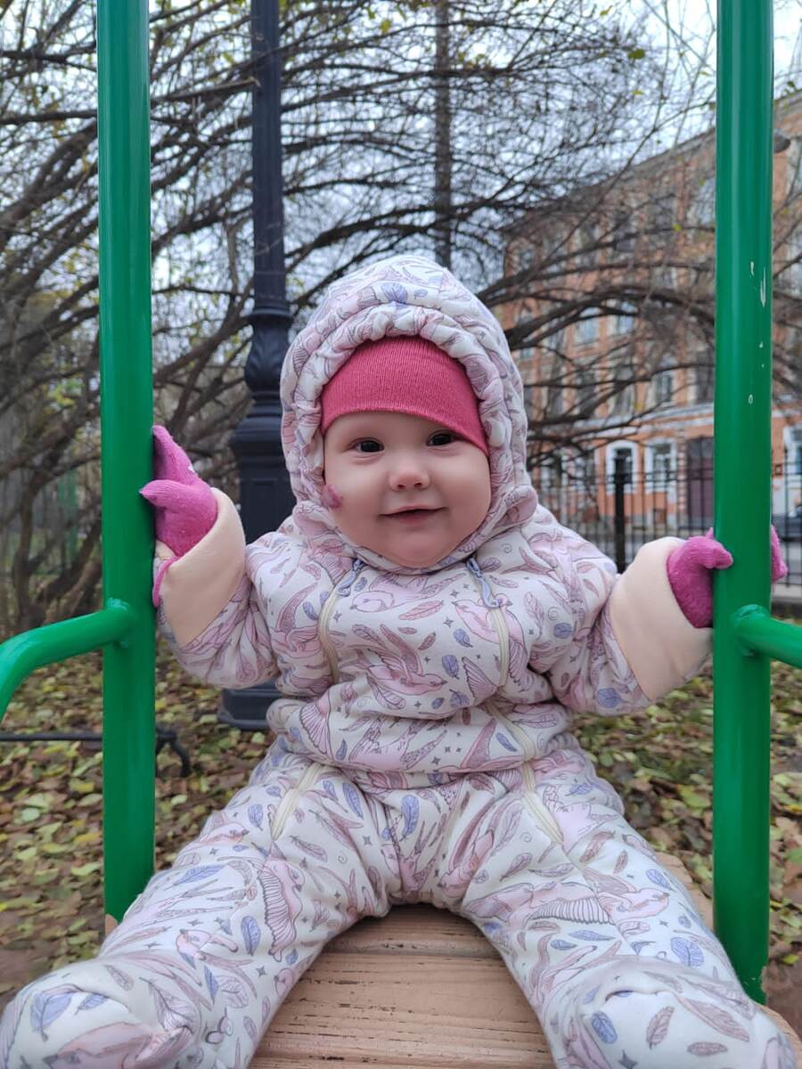 Наше ДО. Тогда мне не казалась гемангиома такой огромной. Ну есть и есть. Видно и ладно