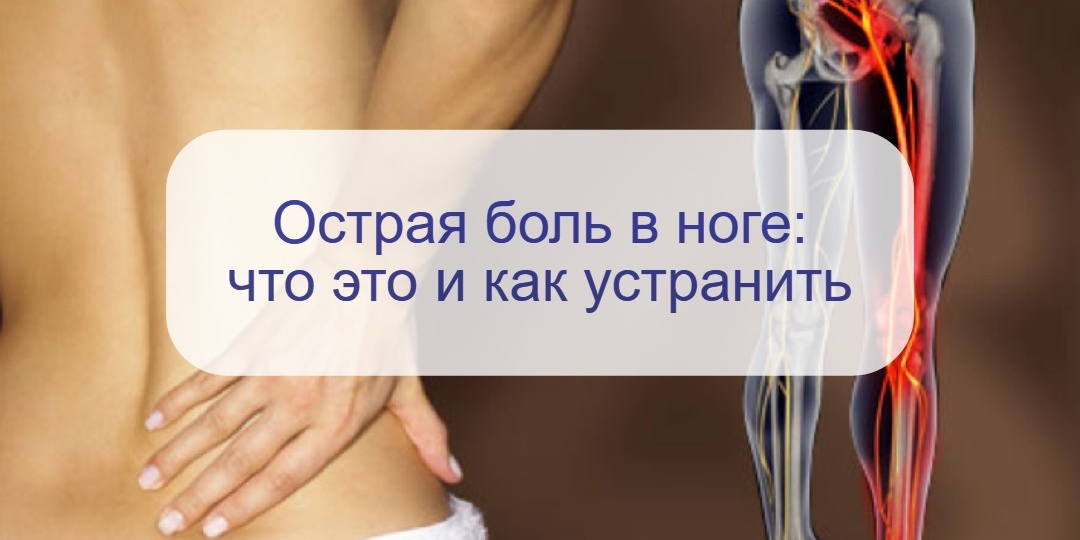 Острая стреляющая боль в ноге, которая приходит и уходит: причины и лечение