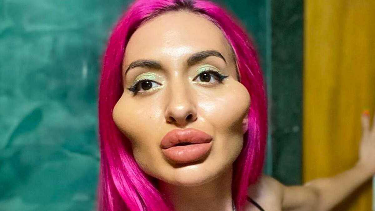 Косметолог с филерами, ботоксом. Фото из открытых источников.