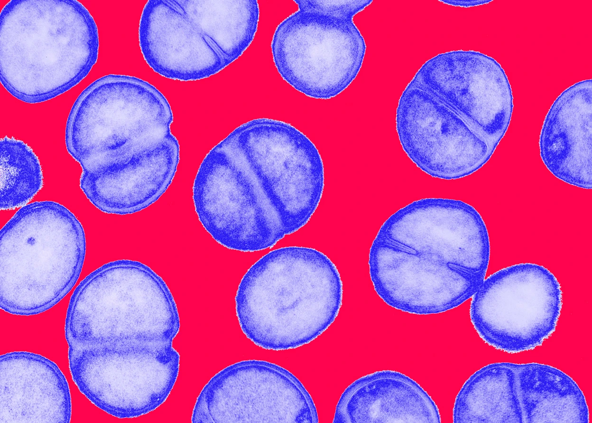 MRSA - один из многих патогенов, которые становятся всё более смертоносными из-за резистентности к противомикробным препаратам. Иллюстрация: Biomedical Imaging Unit, Southampton General Hospital/Science Photo Library