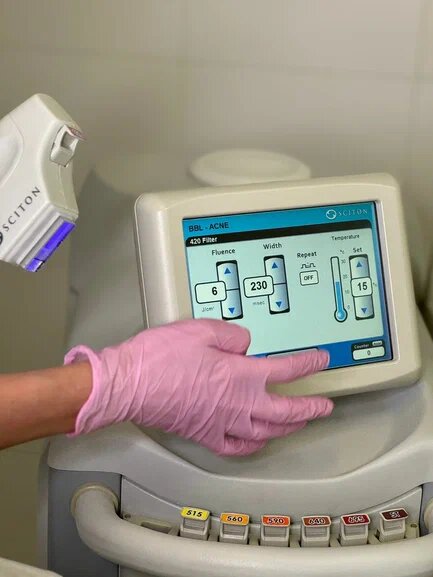 В клинике Telo’s Beauty предлагаются различные аппаратные методики, направленные на борьбу с акне и его последствиями