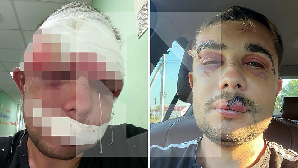     Группа хулиганов жестоко избила тренера по боксу в Белгородской области РЕН ТВ