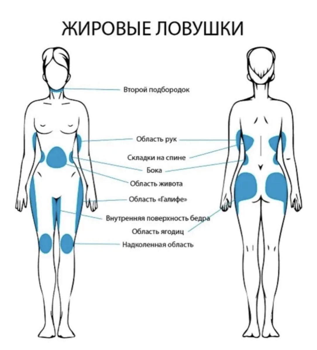 Локальные жировые отложения.