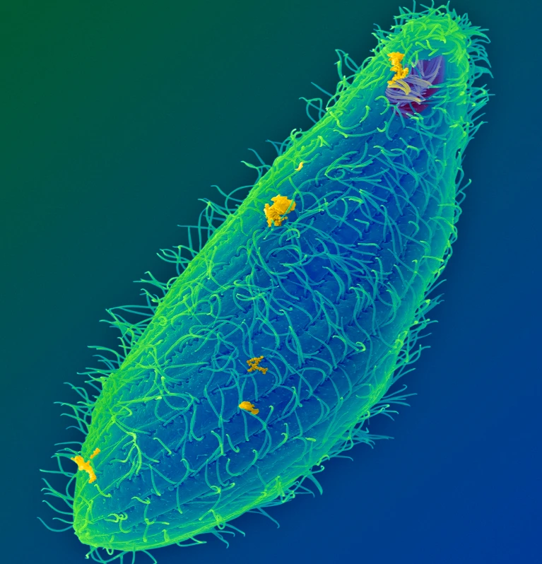 Tetrahymena thermophila, водный организм, в котором был обнаружен рибозим. Фото: Dennis Kunkel Microscopy/SPL