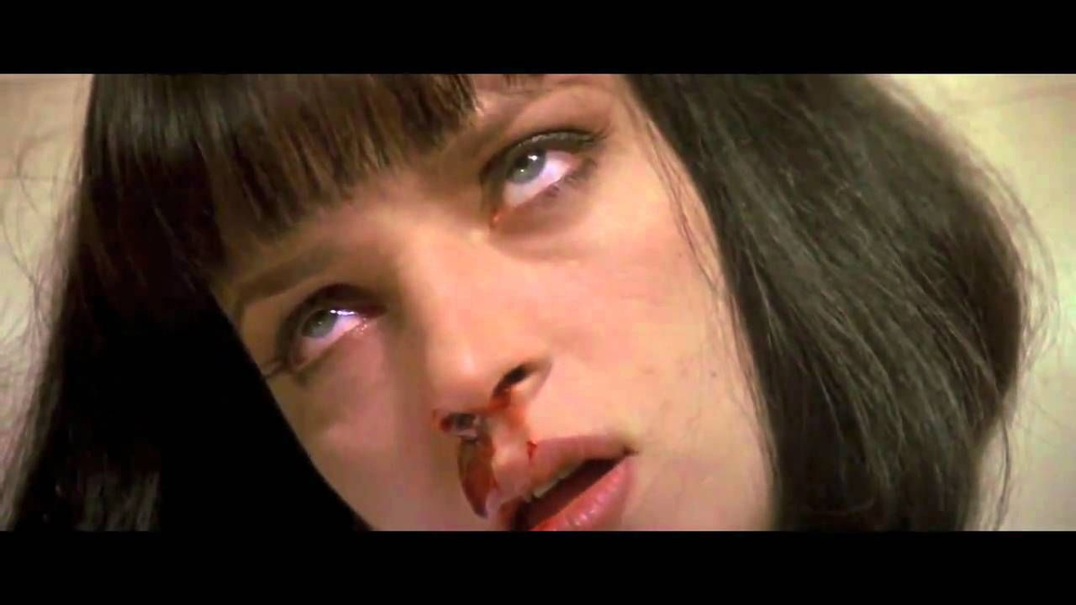 Носовое кровотечение можно быстро остановить, если соблюдать простые правила: опустить голову, не сморкаться и приложить лёд. 