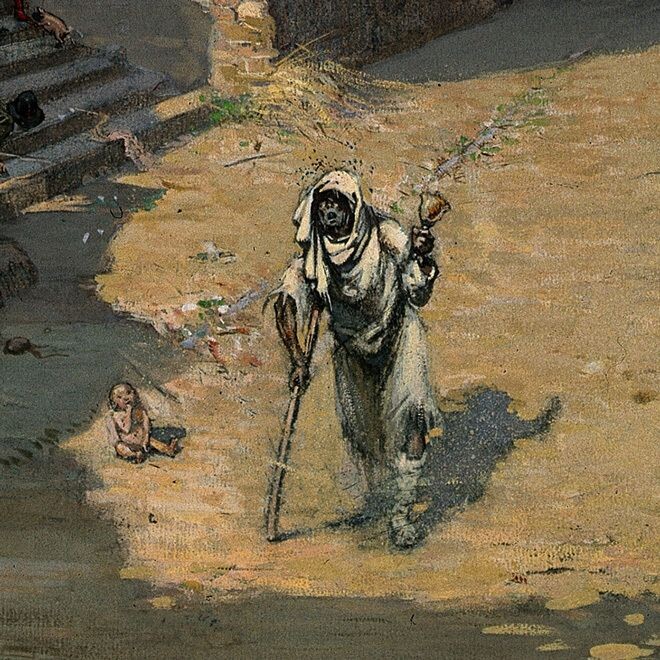 Человек, болеющий проказой. 