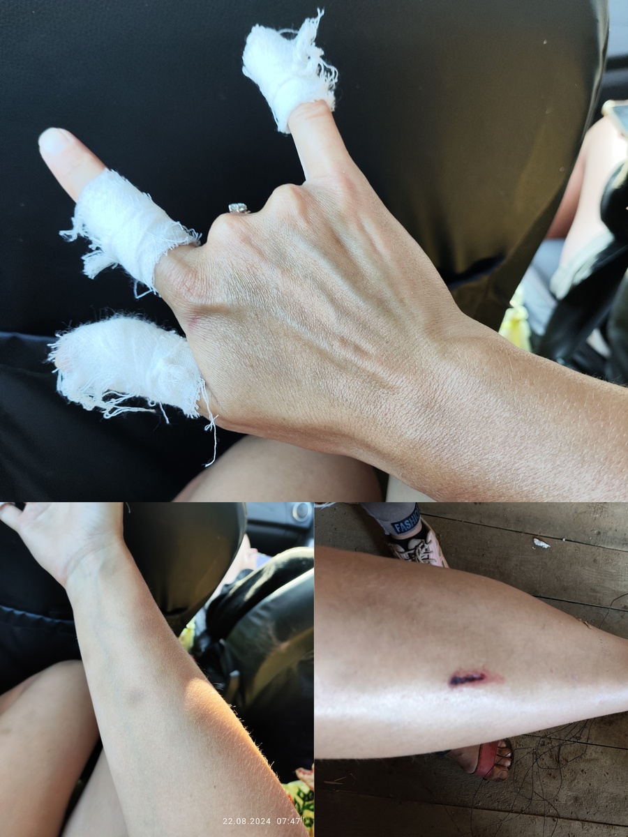 Да и сама я немного перевязана😂