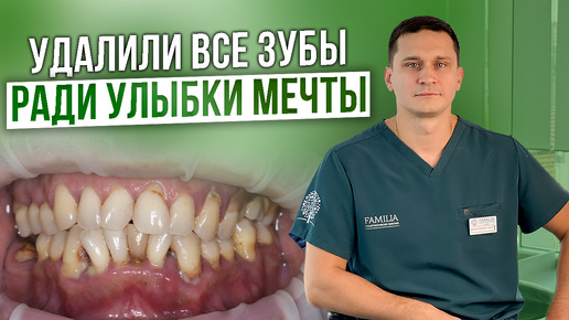 Удаление 27 зубов одномоментно! / История Улыбки