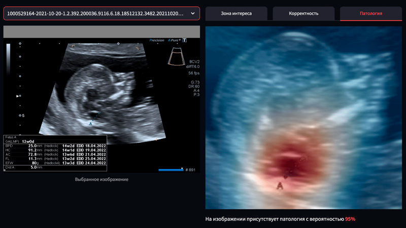Источник: Яндекс фотобанк