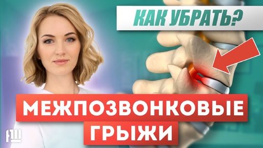 Межпозвонковые грыжи. Как убрать? Эффективные упражнения для снятия боли!