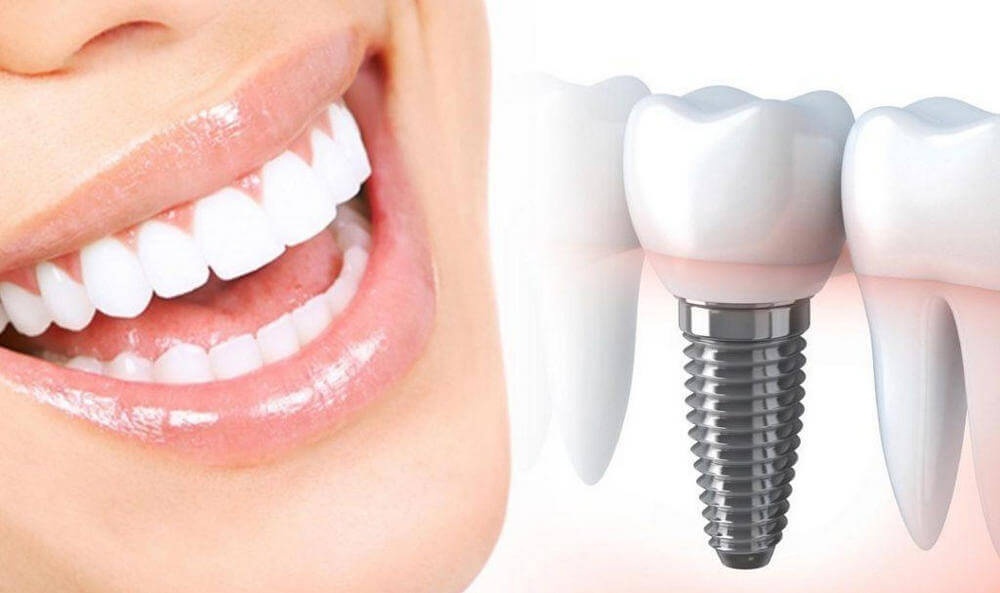 Здоровые зубы 