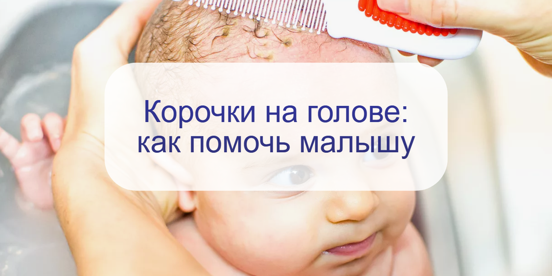 Врач-педиатр пояснила – нужно ли удалять корочки на голове младенца: ответ вас удивит