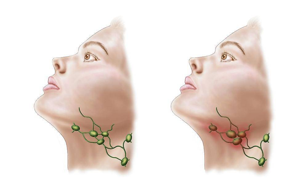 Слава здоровые лимфоузлы, справа воспаление лимфоузлы 
