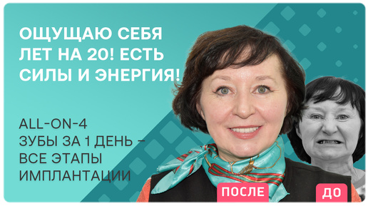 Новые зубы за 1 день! Как проходит лечение 👉 все этапы в одном видео