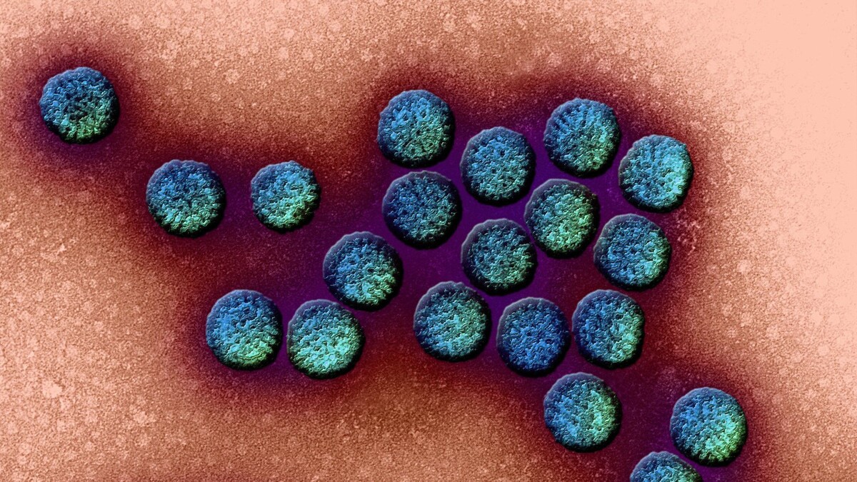 Ротавирус под микроскопом