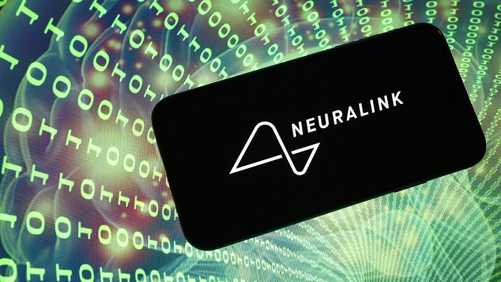 Neuralink. Фотография: Ведомости