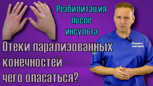 Отеки конечностей парализованных конечностей - чего опасаться, как избавиться.