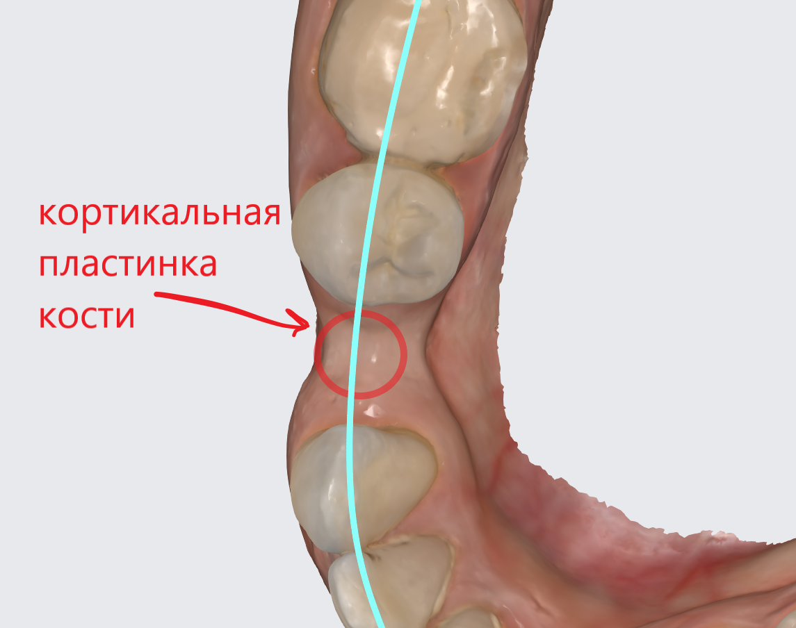 Проблемная зона