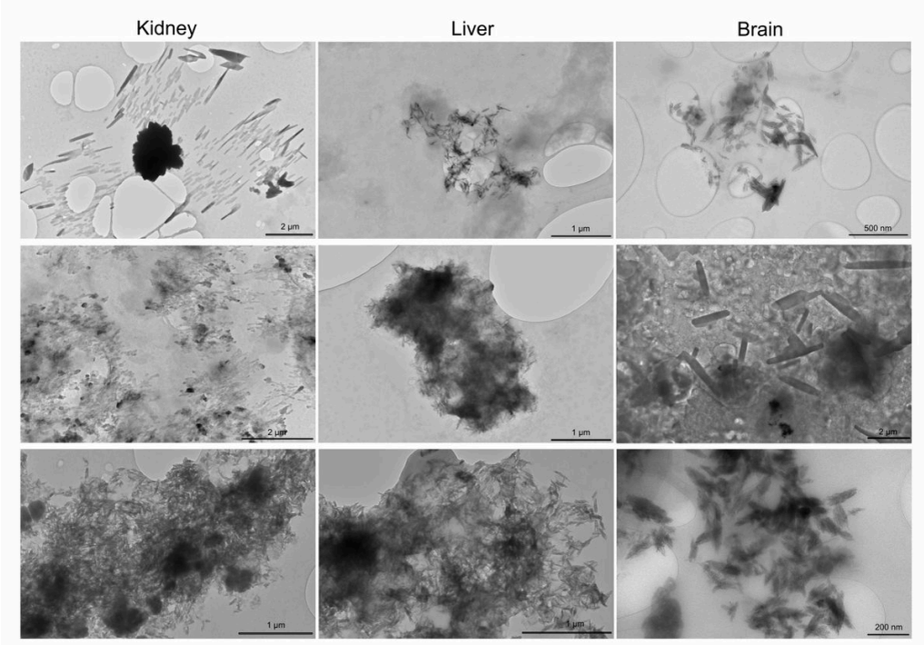 Примеры изображений твердых наночастиц, полученных из образцов почек (слева), печени (в центре) и мозга (справа), сделанных с помощью просвечивающей электронной микроскопии (ПЭМ). Хотя ПЭМ не позволяет провести спектроскопическую идентификацию молекулярного состава частиц, основная масса частиц, которые по данным ИК-Фурье спектроскопии нарушенного полного внутреннего отражения (НПВО-ИК-Фурье) являются преимущественно полимерными, по-видимому, имеет такие размеры и формы. Осколкообразный вид с размерами от микрометровых до нанометровых позволяет предположить состав из состаренного, хрупкого полимера. 