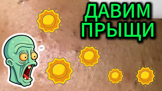 Звезда в шоке дзен. Звезда в шоке дзен