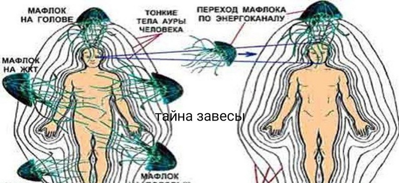 Наглядный пример прицепившихся паразитов .