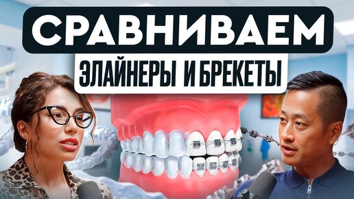 БРЕКЕТЫ ИЛИ ЭЛАЙНЕРЫ ✅❌ Что выбрать в 2024 году? Плюсы и минусы брекетов