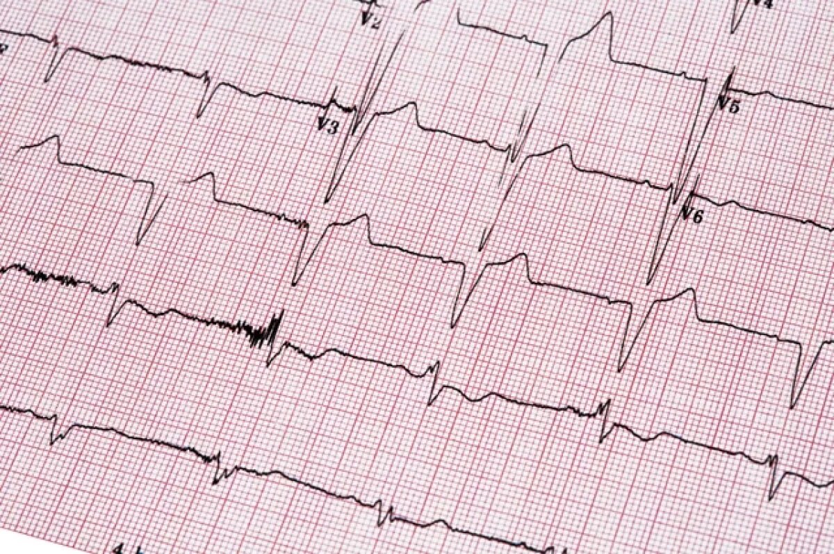    Вес имеет значение.