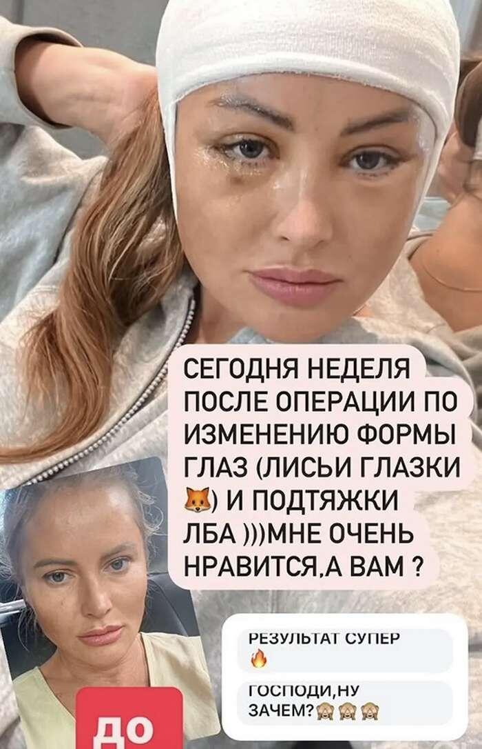 -3