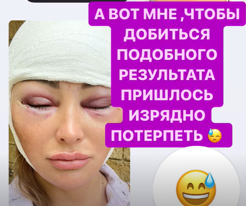 -4