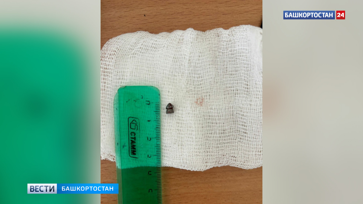    Играли с пневматикой: в Уфе врачи извлекли пули у двух подростков
