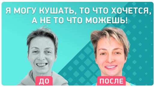 Как питаться с протезами на имплантах 👉 отзыв реального пациента