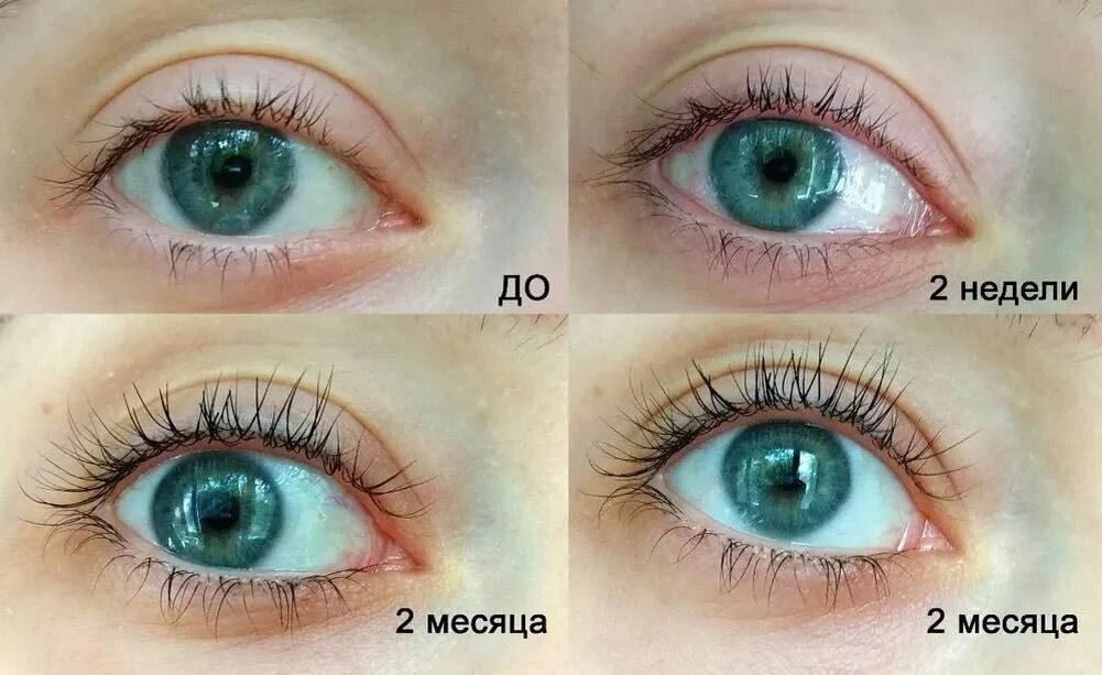 Отзыв с одной из площадок