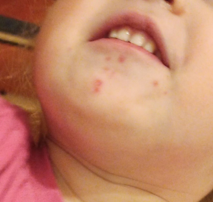 Вот так это выглядело на лице