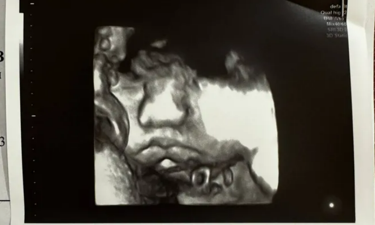 Мария Погребняк показала фотографию малыша, сделанную во время планового УЗИ