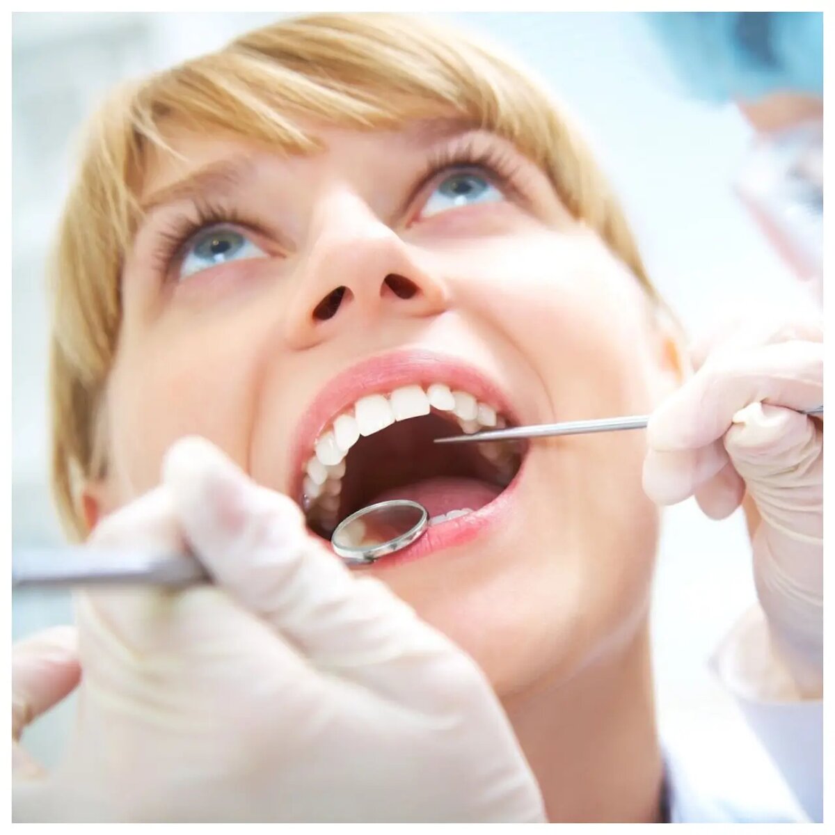    Основной причиной развития гингивита является скопление зубного налета и камня на поверхности зубов и в десневых карманах