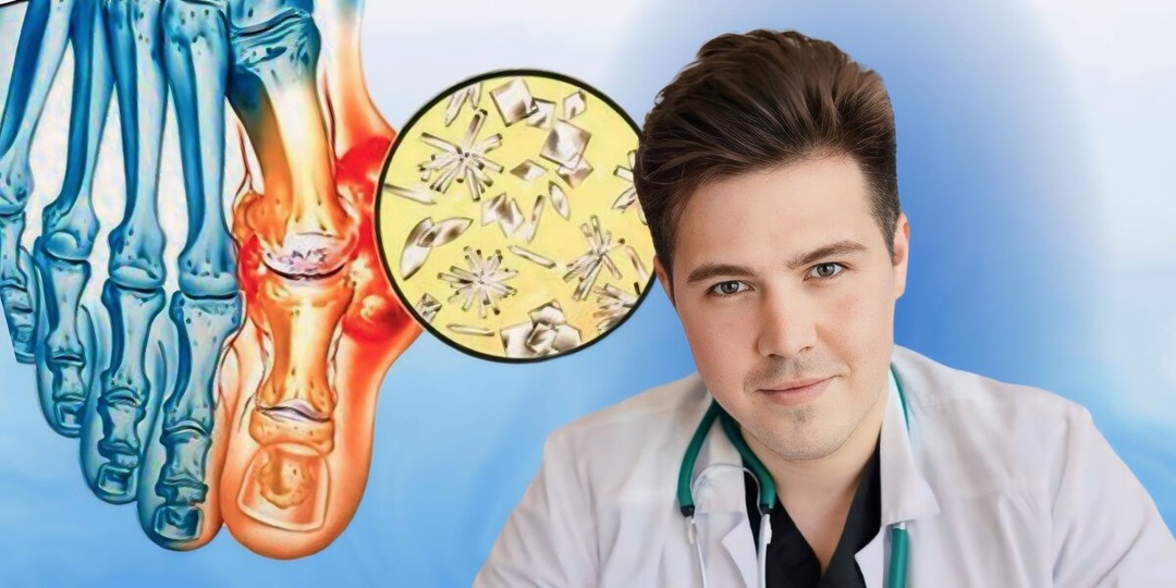 Мочевая кислота - коварный враг суставов: 6 проверенных способов дать ей отпор